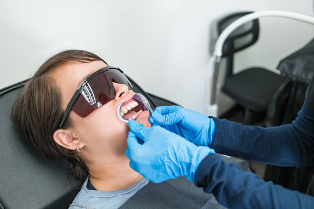 Best Emergency Wisdom Teeth Removal in Boone, NC