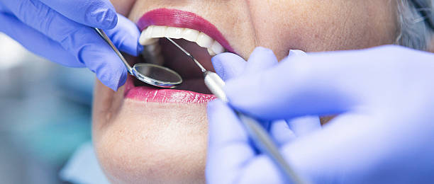 Best Walk-In Emergency Dentist in Boone, NC